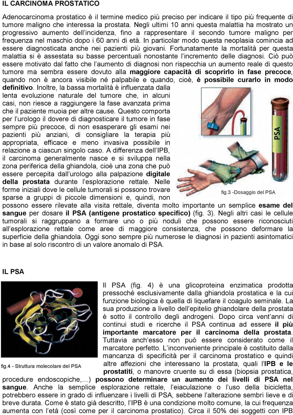 In particolar modo questa neoplasia comincia ad essere diagnosticata anche nei pazienti più giovani.