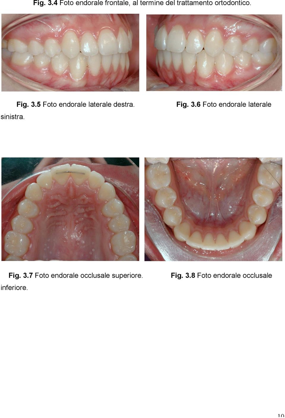 ortodontico. sinistra. 5 Foto endorale laterale destra.
