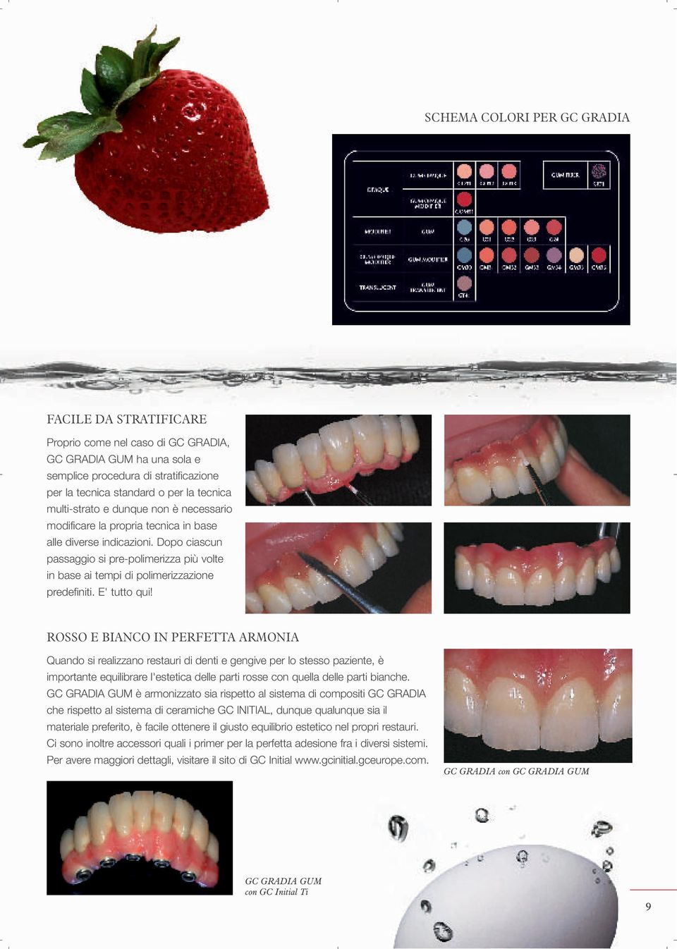 ROSSO E BIANCO IN PERFETTA ARMONIA Quando si realizzano restauri di denti e gengive per lo stesso paziente, è importante equilibrare l'estetica delle parti rosse con quella delle parti bianche.