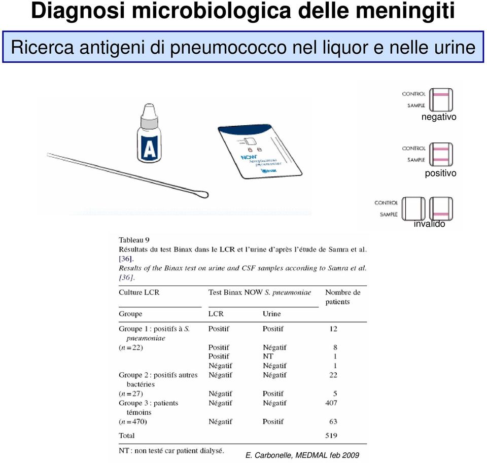 pneumococco nel liquor e nelle urine