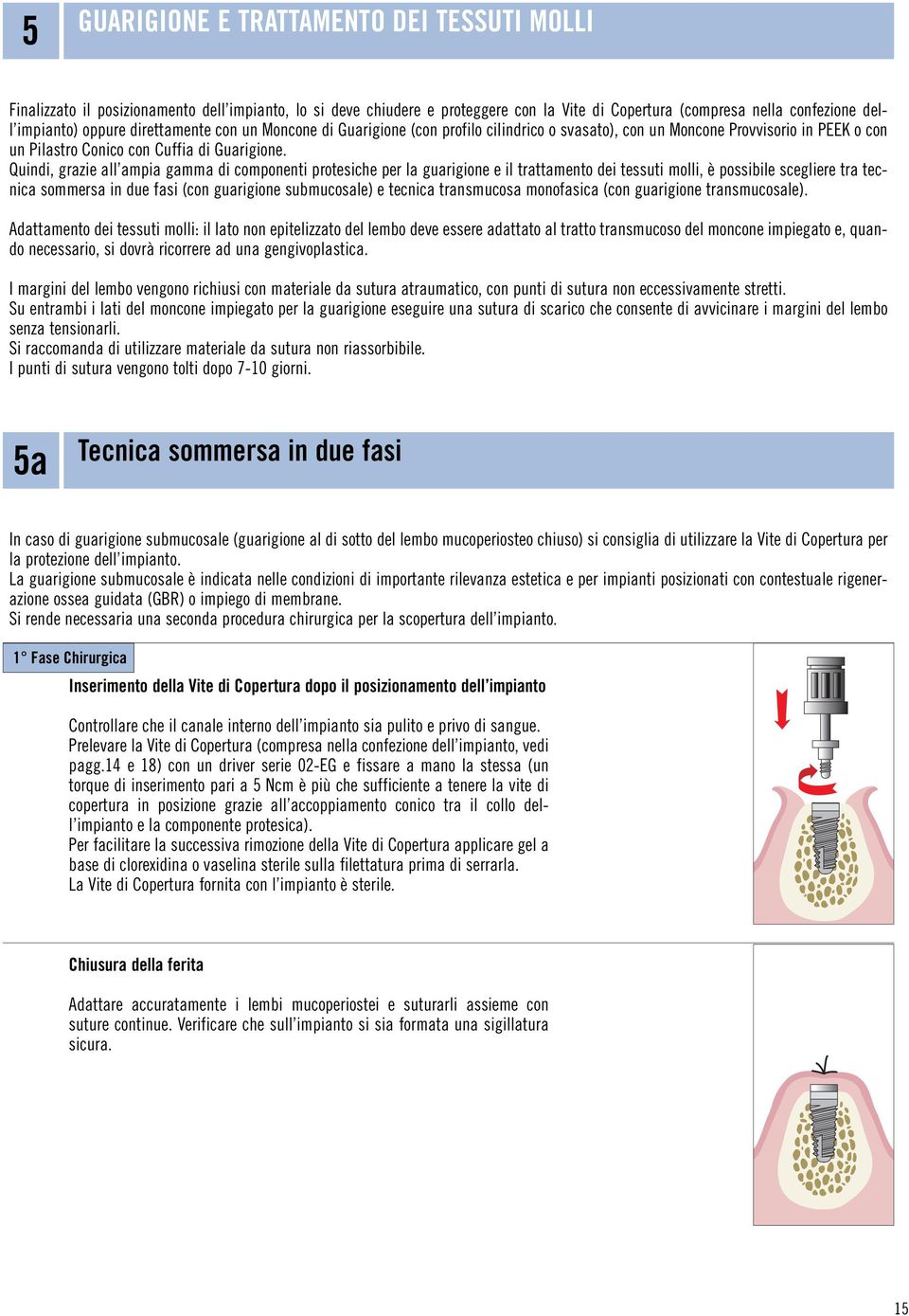 Quindi, grazie all ampia gamma di componenti protesiche per la guarigione e il trattamento dei tessuti molli, è possibile scegliere tra tecnica sommersa in due fasi (con guarigione submucosale) e