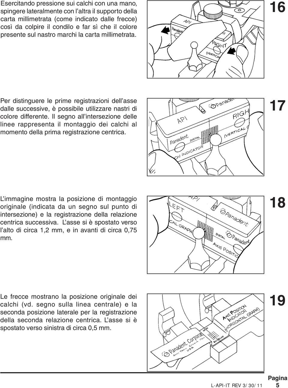 Il segno all intersezione delle linee rappresenta il montaggio dei calchi al momento della prima registrazione centrica.