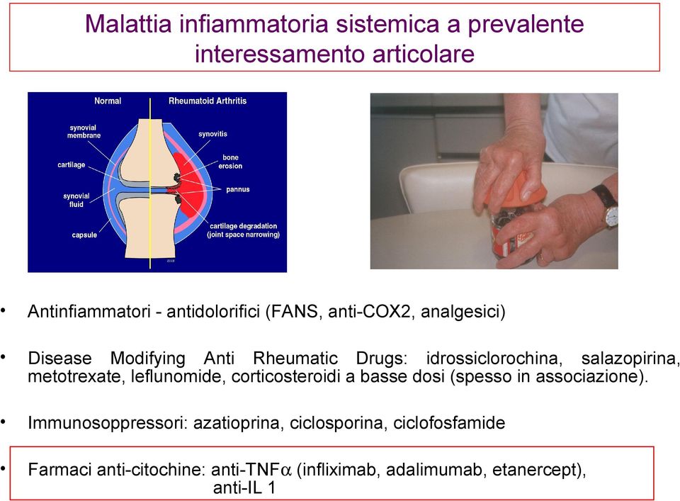 metotrexate, leflunomide, corticosteroidi a basse dosi (spesso in associazione).