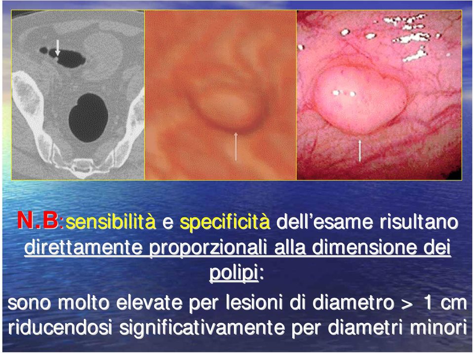 dimensione dei polipi: sono molto elevate per lesioni