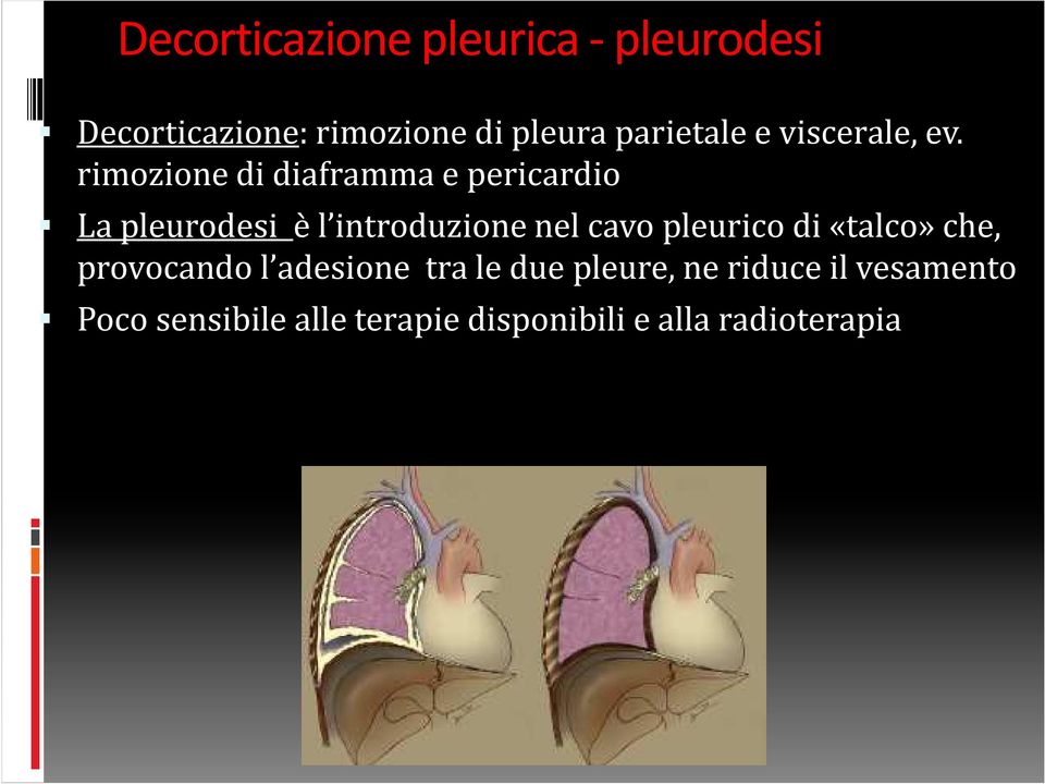 rimozione di diaframma e pericardio La pleurodesi è l introduzione nel cavo