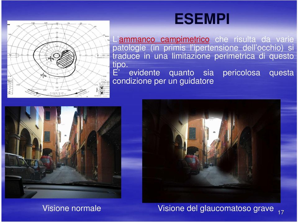 perimetrica di questo tipo.