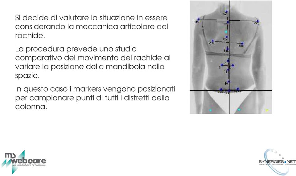 La procedura prevede uno studio comparativo del movimento del rachide al variare la