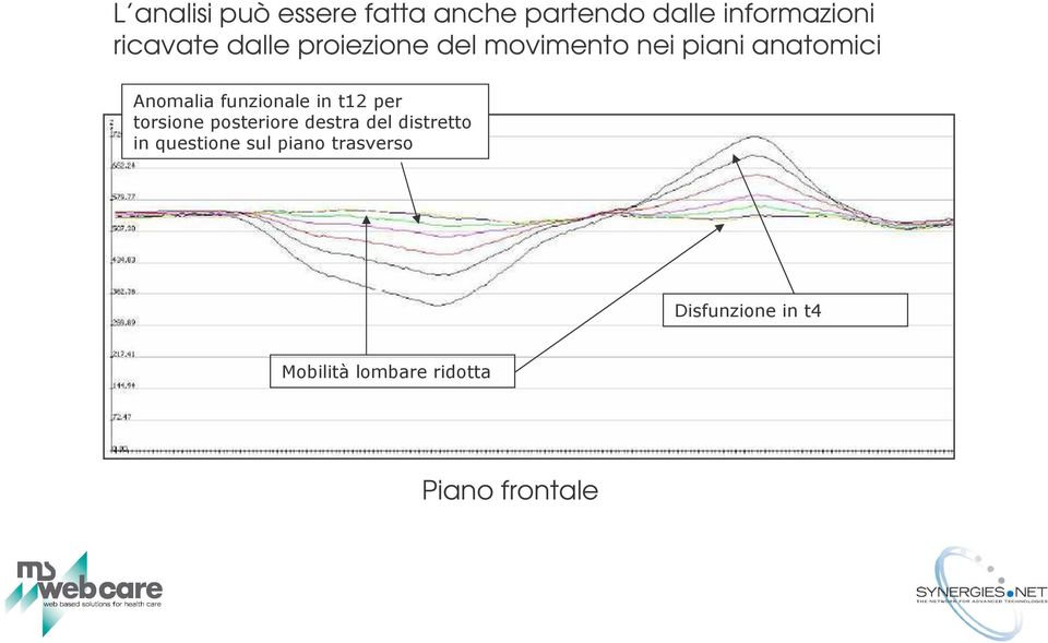 ricavate dalle proiezione del