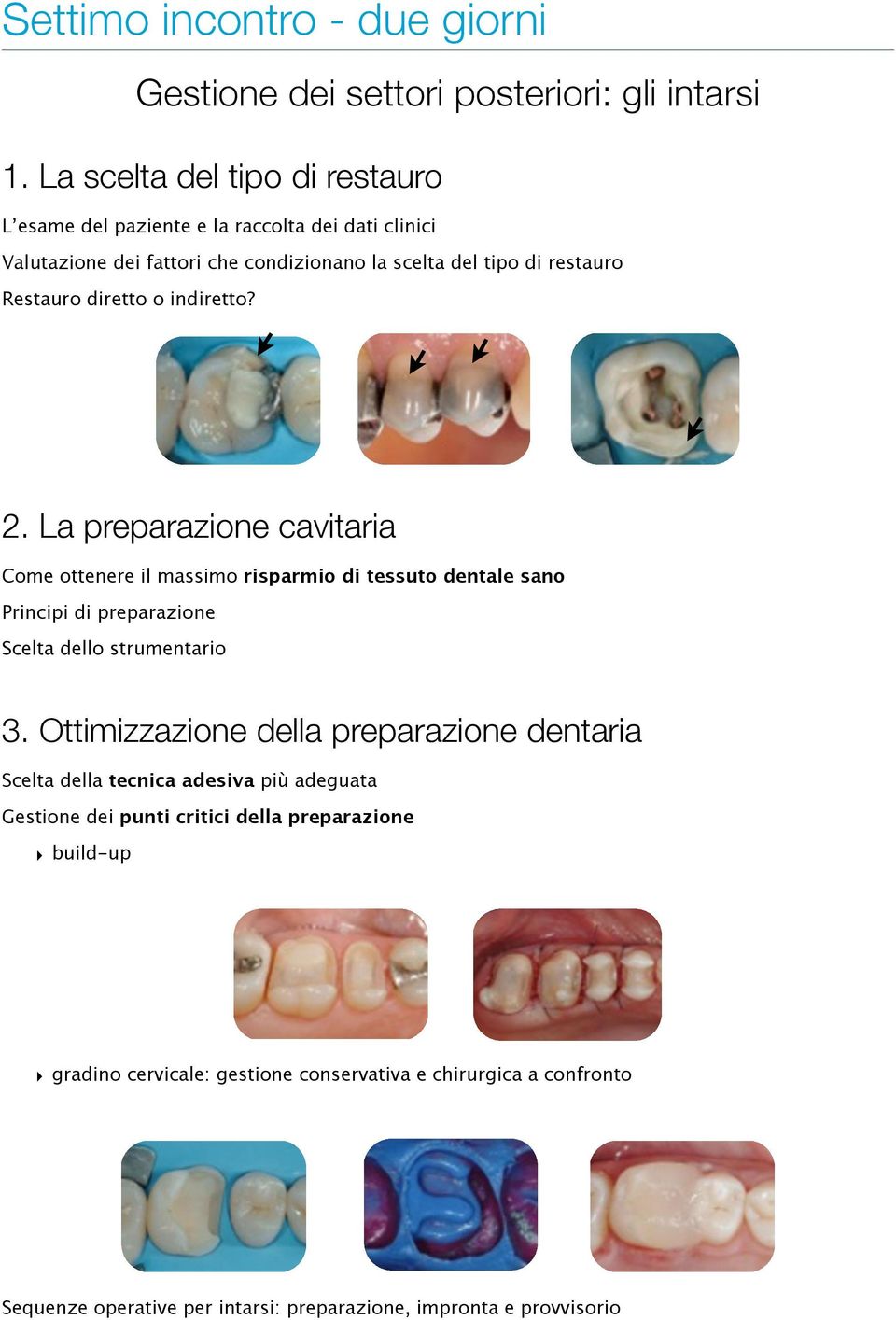 diretto o indiretto? 2. La preparazione cavitaria Come ottenere il massimo risparmio di tessuto dentale sano Principi di preparazione Scelta dello strumentario 3.