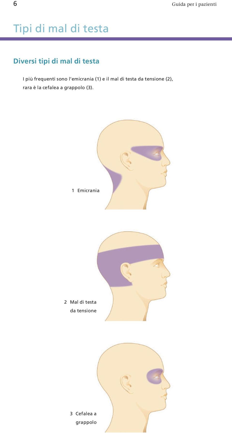 di testa da tensione (2), rara è la cefalea a grappolo (3).