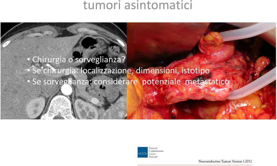 Se chirurgia: localizzazione,