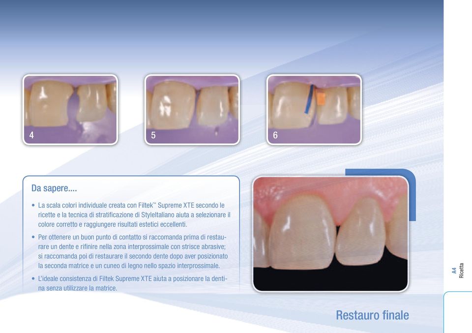 corretto e raggiungere risultati estetici eccellenti.