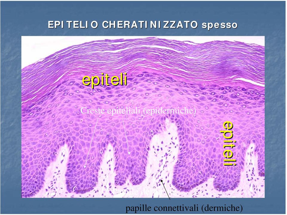 (epidermiche) Papille