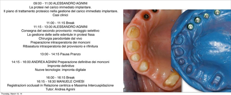 parodontale dal vivo Preparazione intraoperatoria dei monconi RIbasatura intraoperatoria del provvisorio e rifinitura 14:15-16:00 ANDREA AGNINI Preparazione