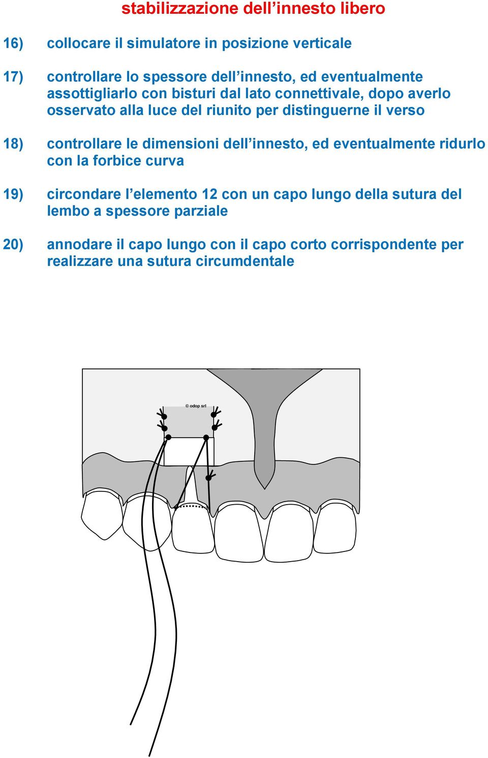 18) controllare le dimensioni dell innesto, ed eventualmente ridurlo con la forbice curva 19) circondare l elemento 12 con un capo lungo