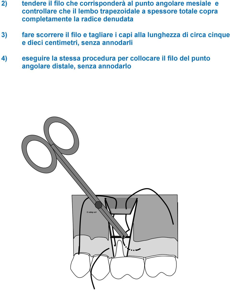 filo e tagliare i capi alla lunghezza di circa cinque e dieci centimetri, senza annodarli 4)