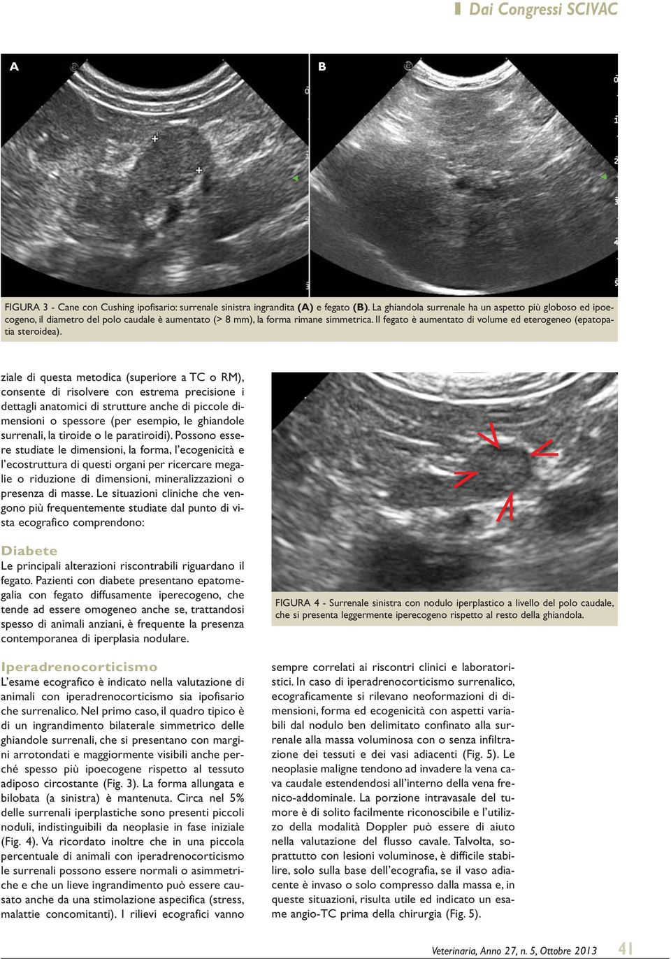 Il fegato è aumentato di volume ed eterogeneo (epatopatia steroidea).