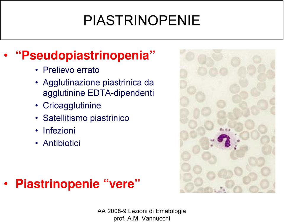 agglutinine EDTA-dipendenti Crioagglutinine