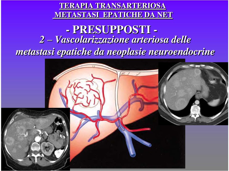 arteriosa delle