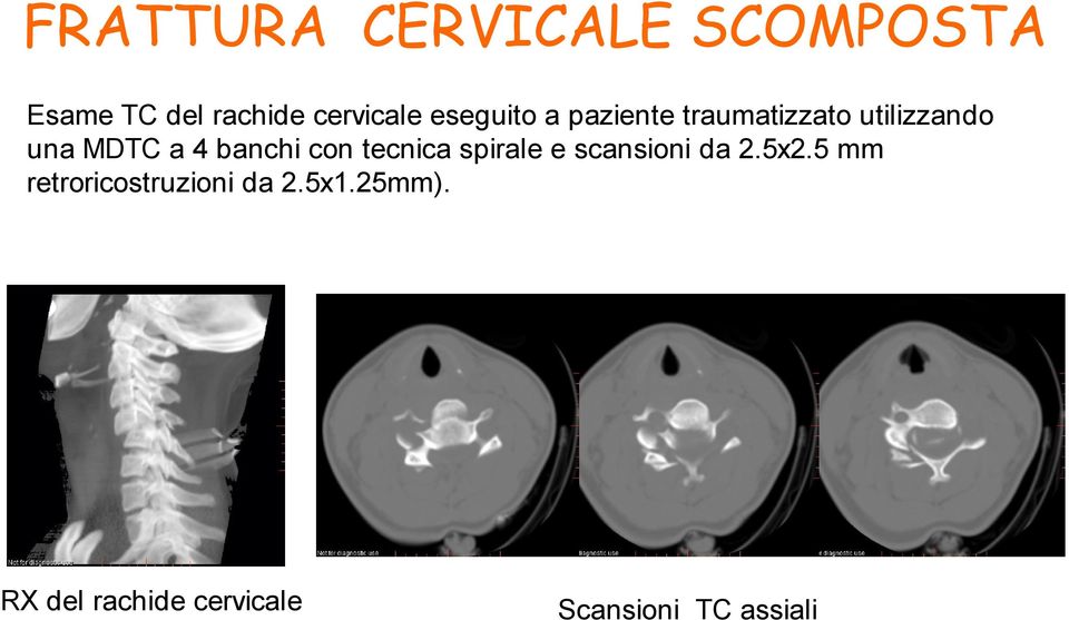 banchi con tecnica spirale e scansioni da 2.5x2.