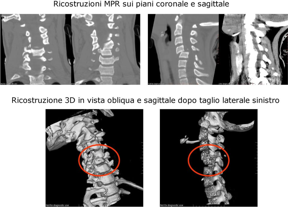 Ricostruzione 3D in vista