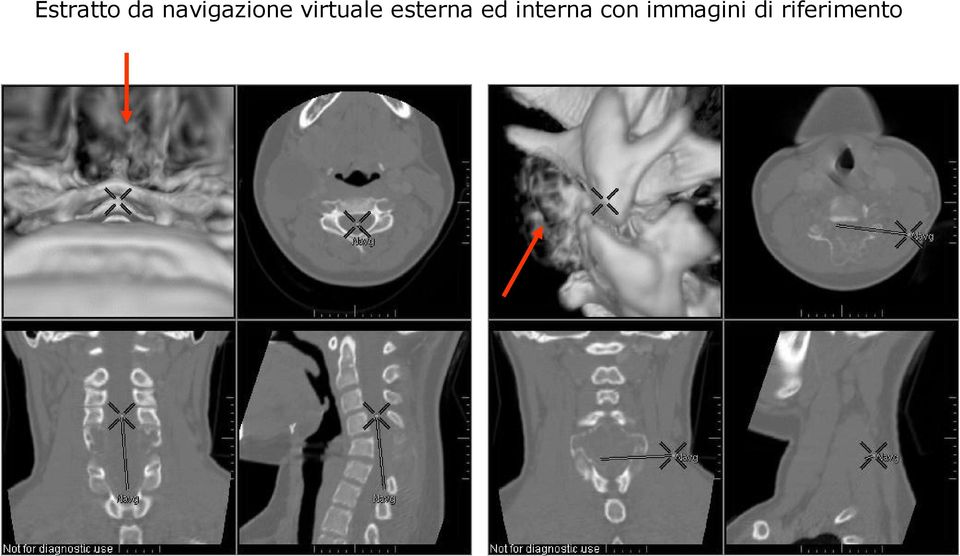 virtuale esterna ed