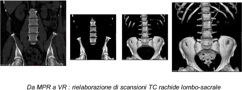 di scansioni TC