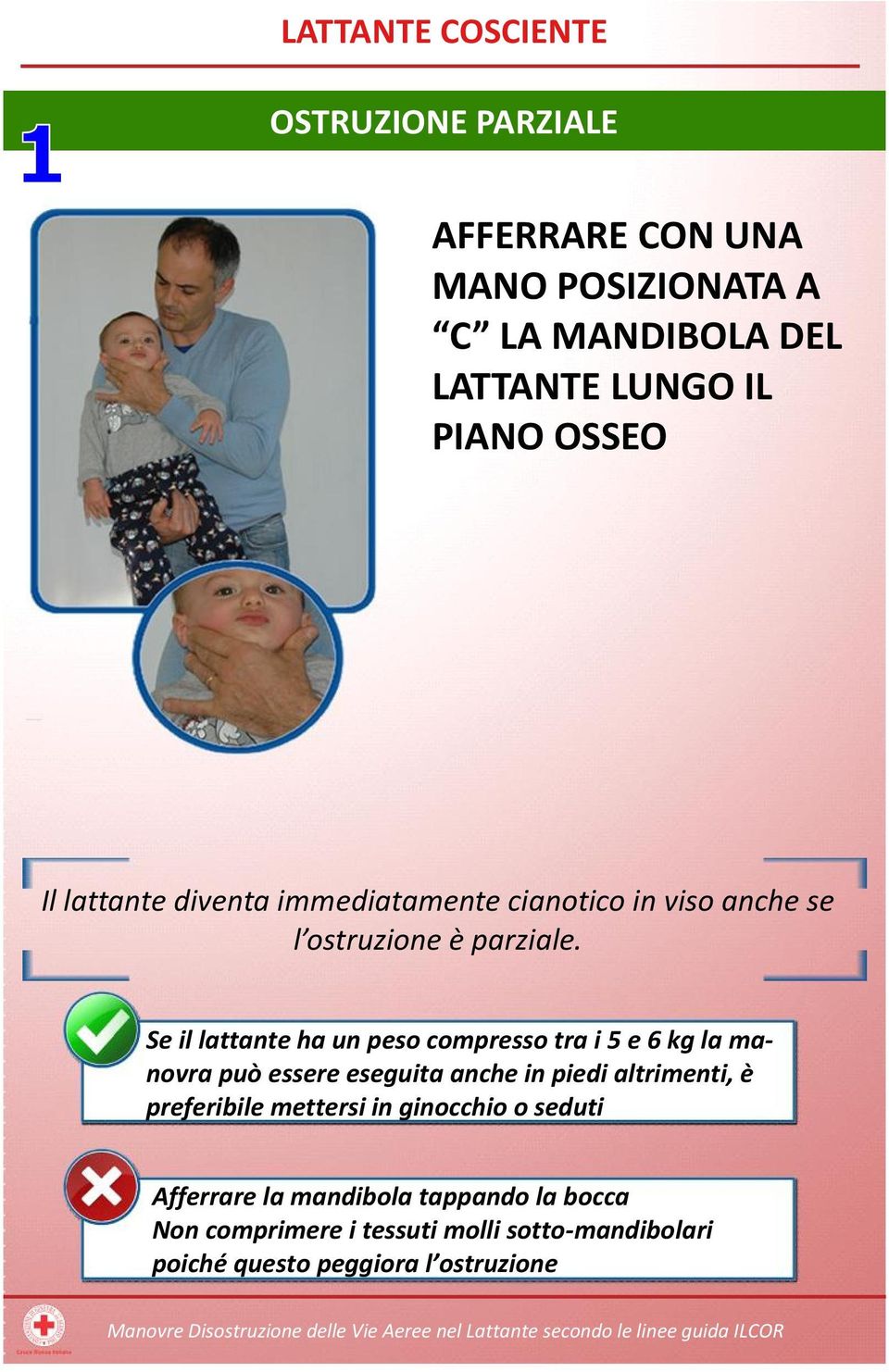 Se il lattante ha un peso compresso tra i 5 e 6 kg la manovra può essere eseguita anche in piedi altrimenti, è preferibile mettersi in