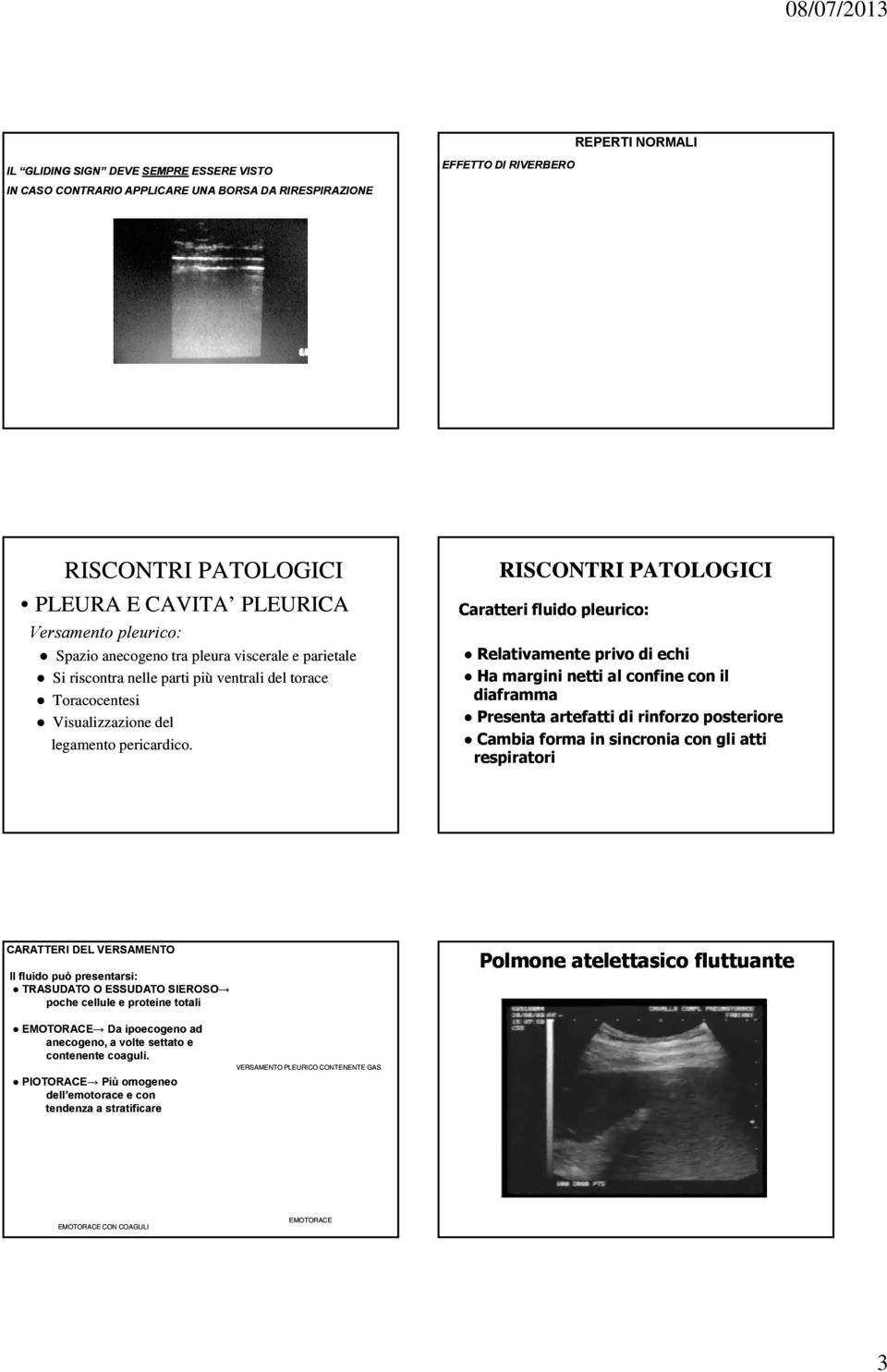 Caratteri fluido pleurico: Relativamente privo di echi Ha margini netti al confine con il diaframma Presenta artefatti di rinforzo posteriore Cambia forma in sincronia con gli atti respiratori