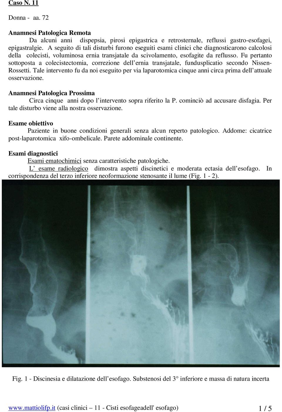 Fu pertanto sottoposta a colecistectomia, correzione dell ernia transjatale, fundusplicatio secondo Nissen- Rossetti.