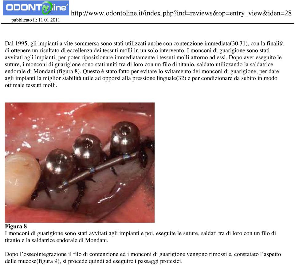 Dopo aver eseguito le suture, i monconi di guarigione sono stati uniti tra di loro con un filo di titanio, saldato utilizzando la saldatrice endorale di Mondani (figura 8).