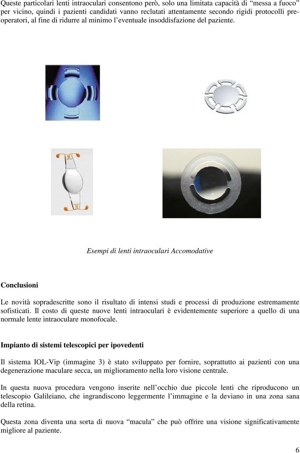 Esempi di lenti intraoculari Accomodative Conclusioni Le novità sopradescritte sono il risultato di intensi studi e processi di produzione estremamente sofisticati.