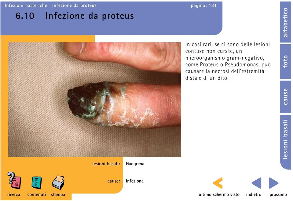 non curate, un microorganismo gram-negativo, come Proteus o