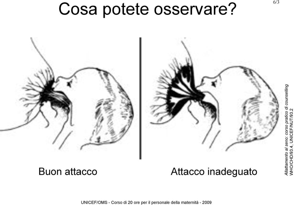 inadeguato Allattamento al seno: