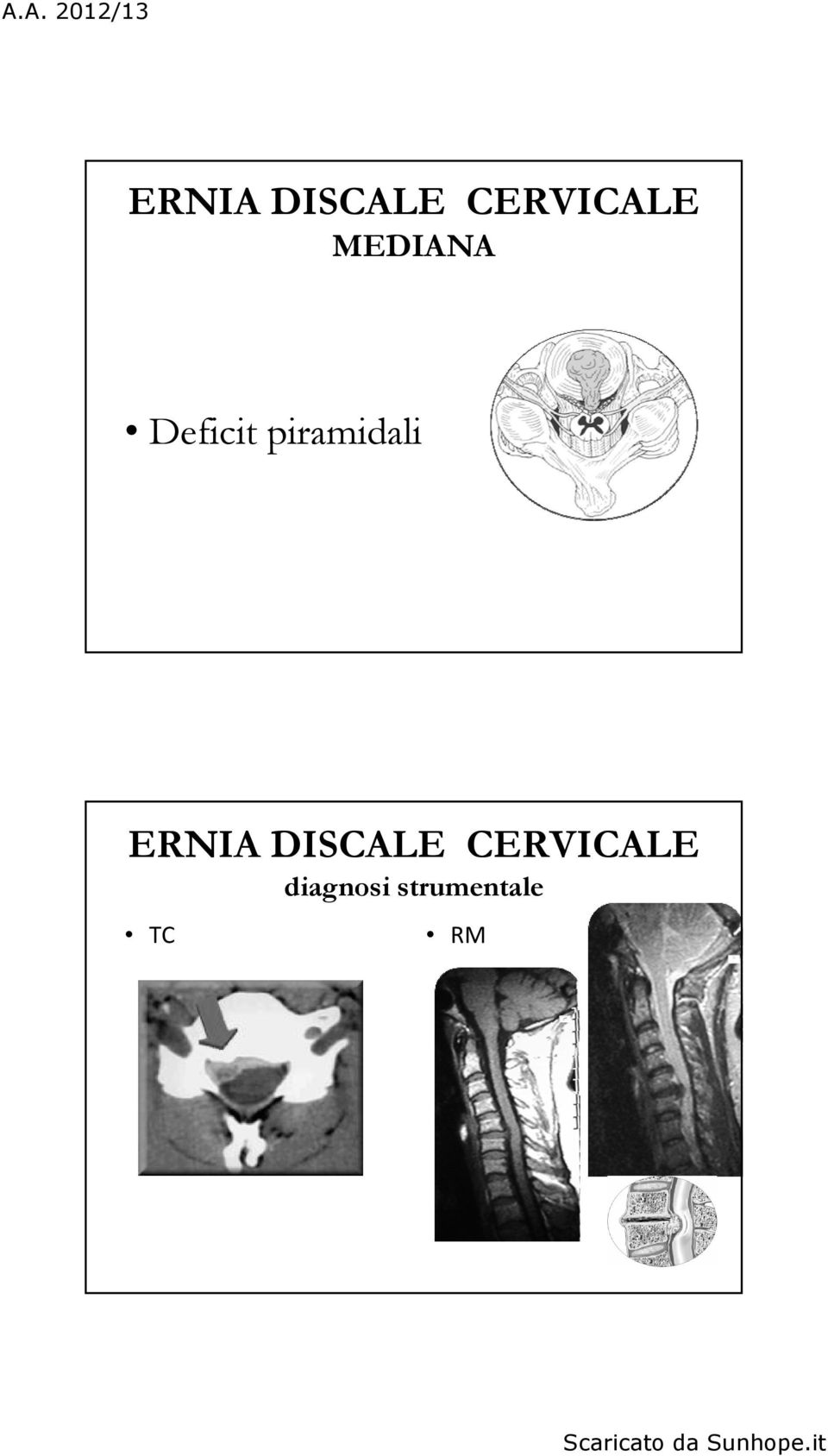 piramidali  diagnosi