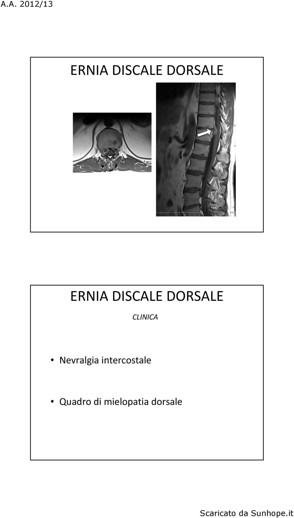 intercostale Quadro di