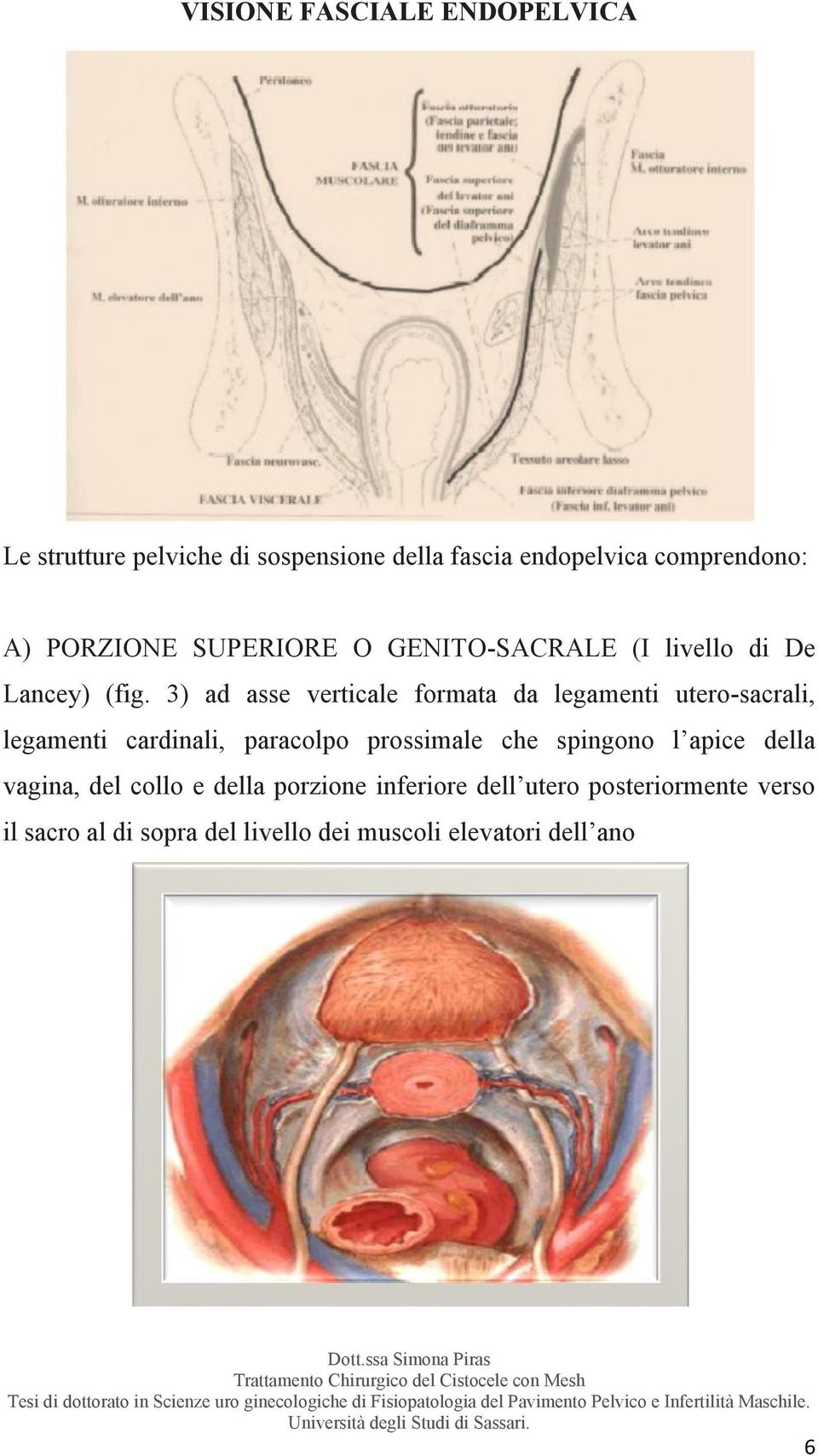 3) ad asse verticale formata da legamenti utero-sacrali, legamenti cardinali, paracolpo prossimale che