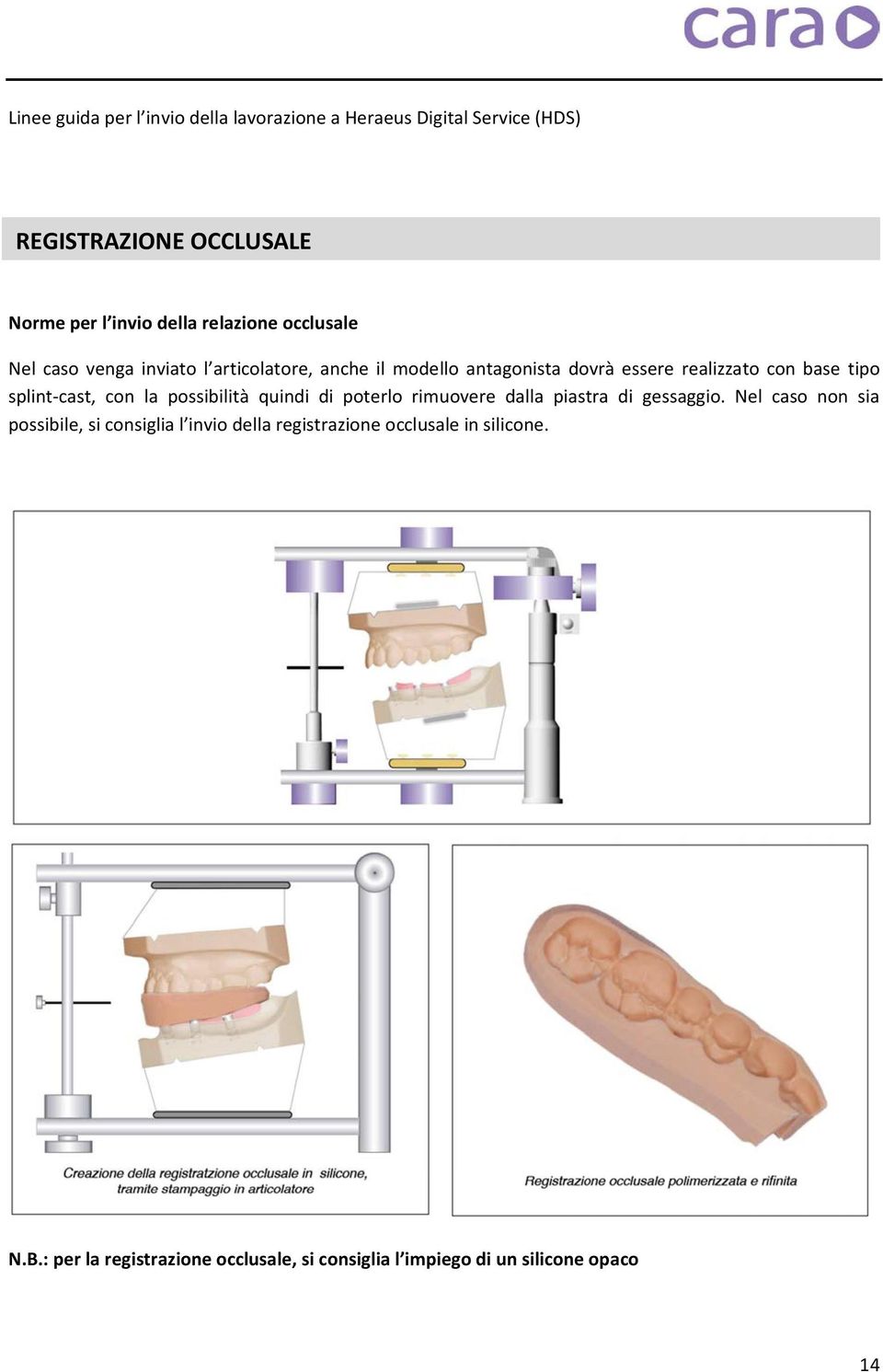 poterlo rimuovere dalla piastra di gessaggio.