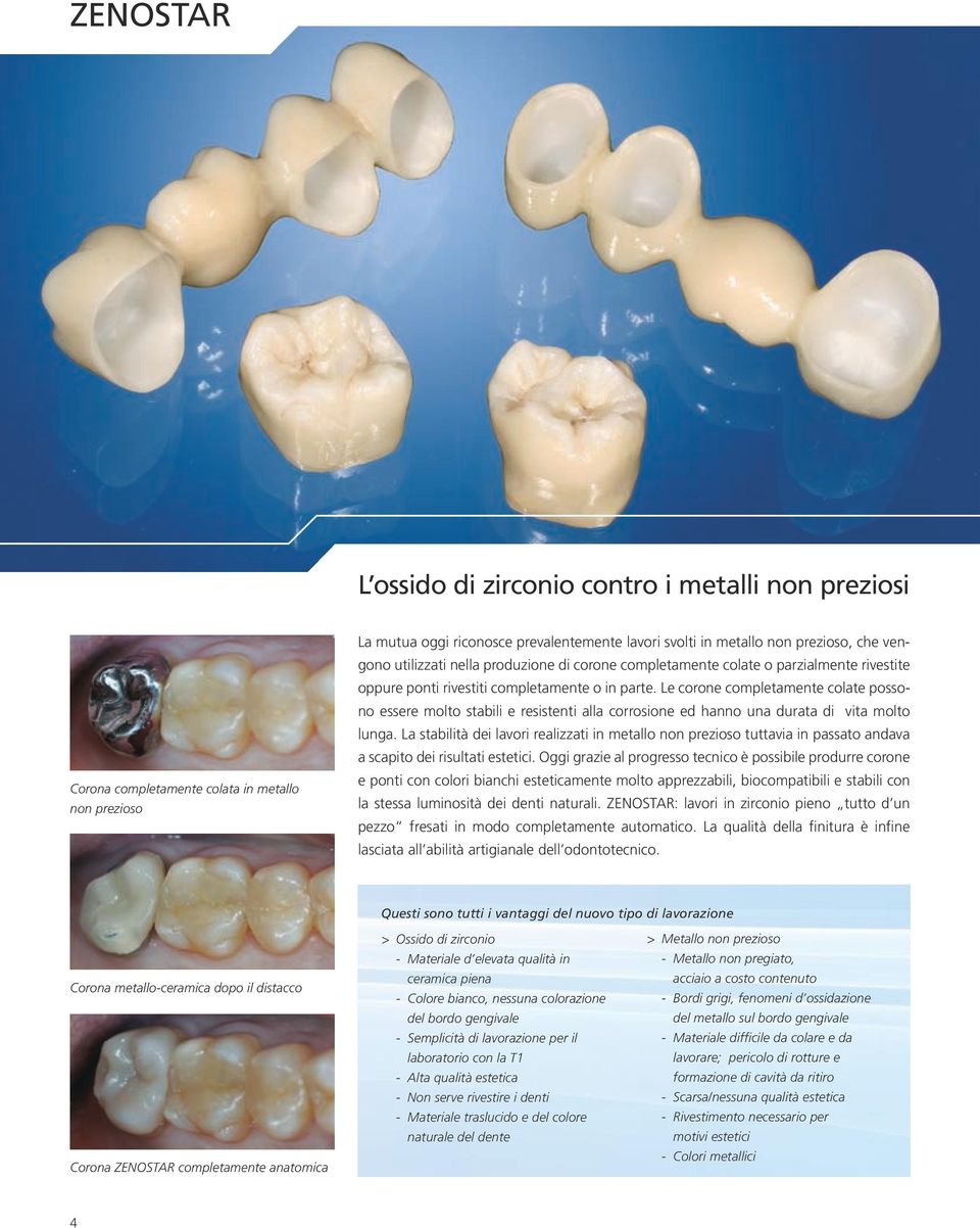 Le corone completamente colate possono essere molto stabili e resistenti alla corrosione ed hanno una durata di vita molto lunga.