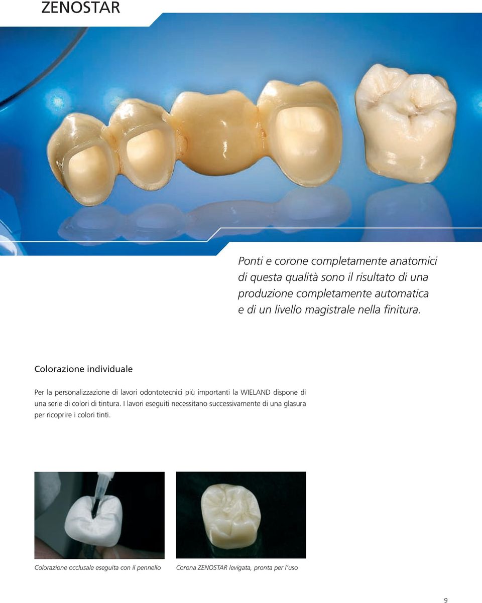 Colorazione individuale Per la personalizzazione di lavori odontotecnici più importanti la WIELAND dispone di una serie di