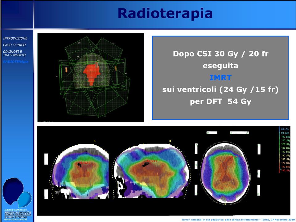 IMRT sui ventricoli (24