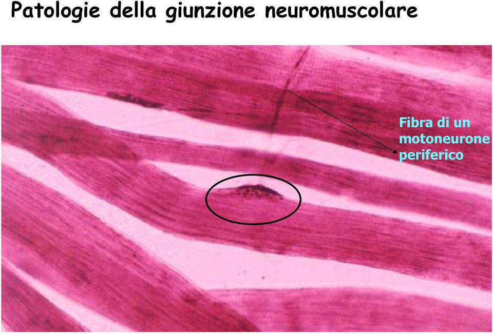 neuromuscolare