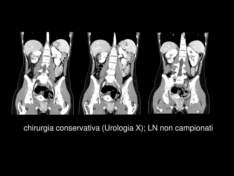 (Urologia X);