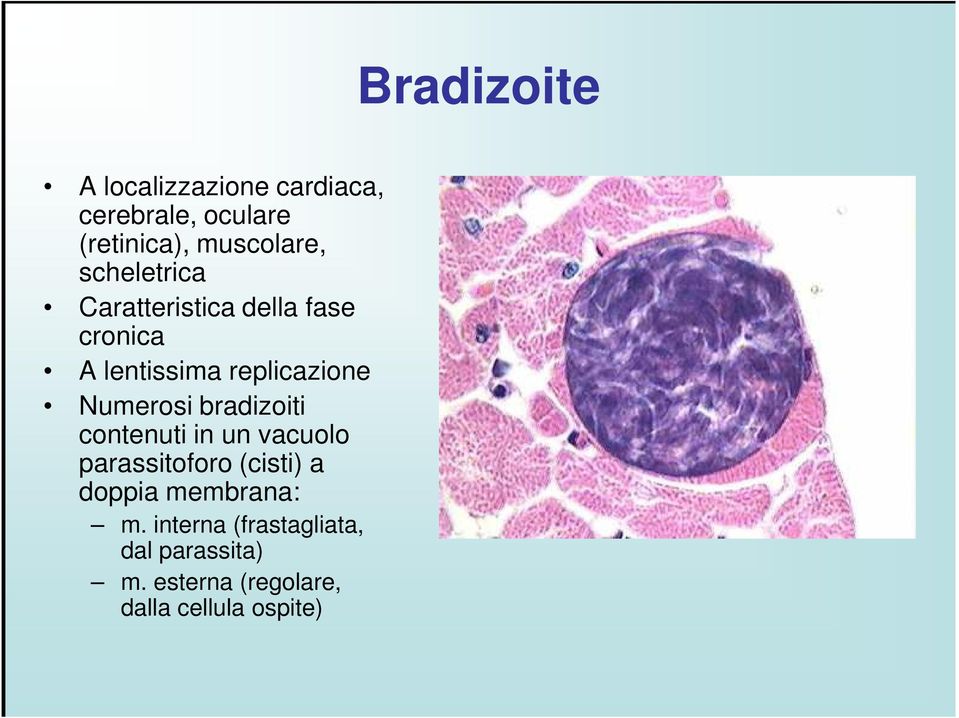 bradizoiti contenuti in un vacuolo parassitoforo (cisti) a doppia membrana: m.