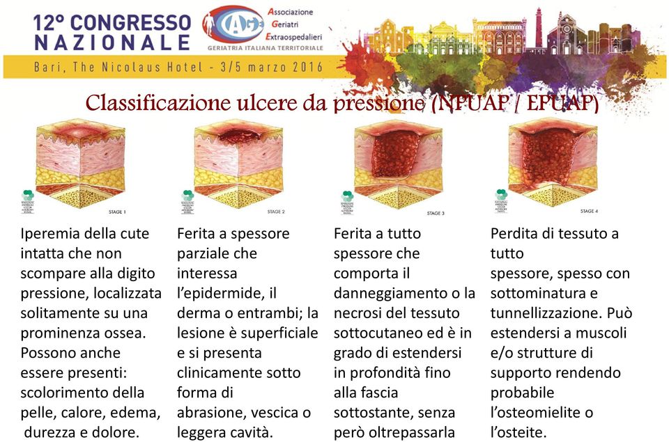 Ferita a spessore parziale che interessa l epidermide, il derma o entrambi; la lesione è superficiale e si presenta clinicamente sotto forma di abrasione, vescica o leggera cavità.