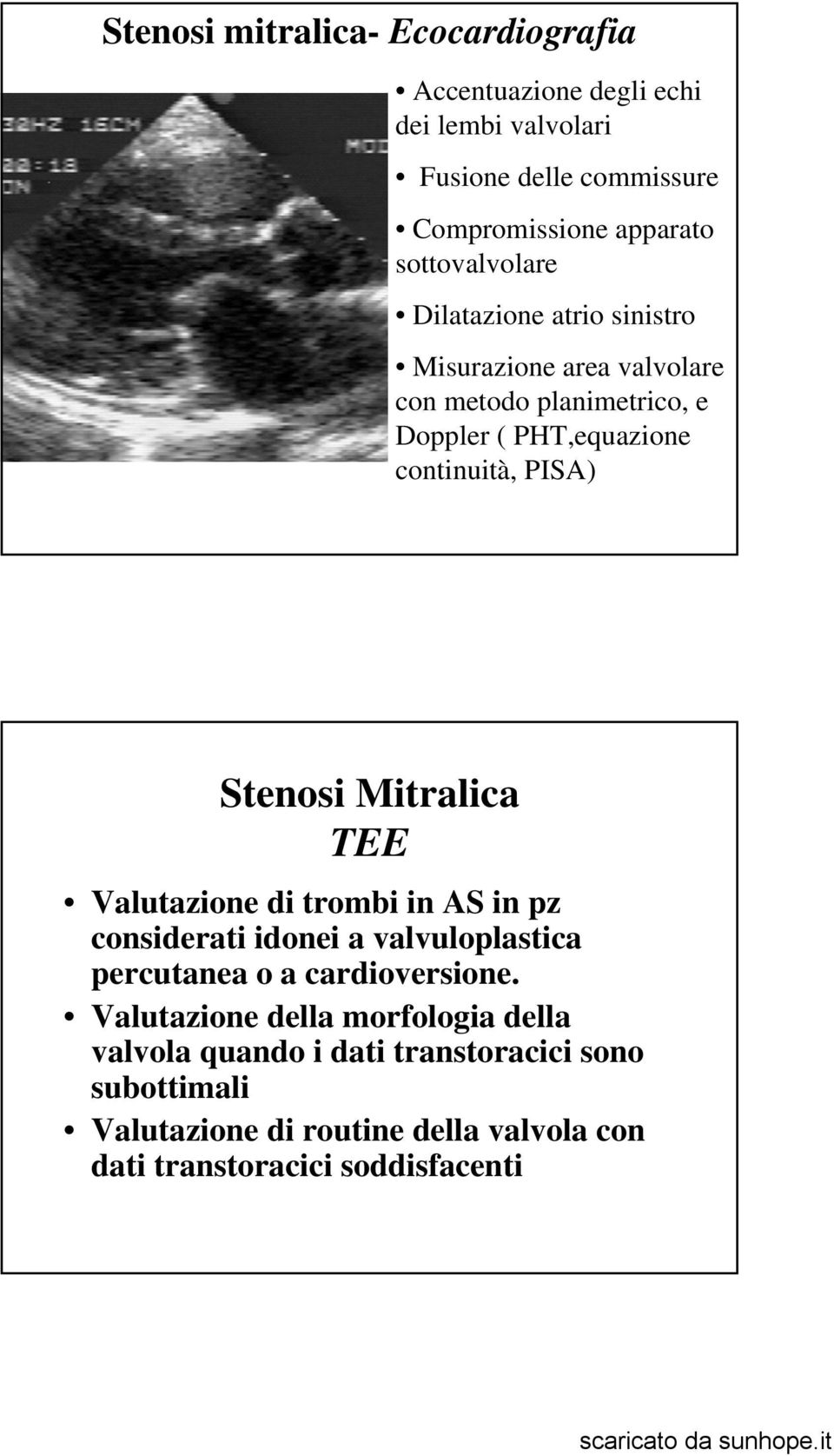 Stenosi Mitralica TEE Valutazione di trombi in AS in pz considerati idonei a valvuloplastica percutanea o a cardioversione.