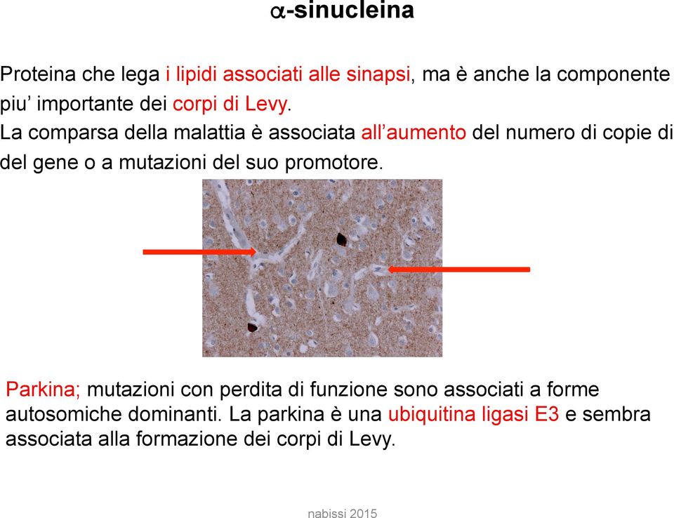 La comparsa della malattia è associata all aumento del numero di copie di del gene o a mutazioni del suo