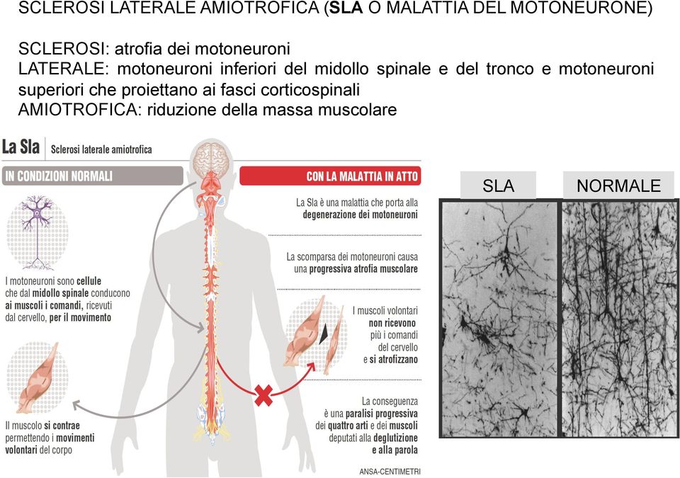 midollo spinale e del tronco e motoneuroni superiori che proiettano ai