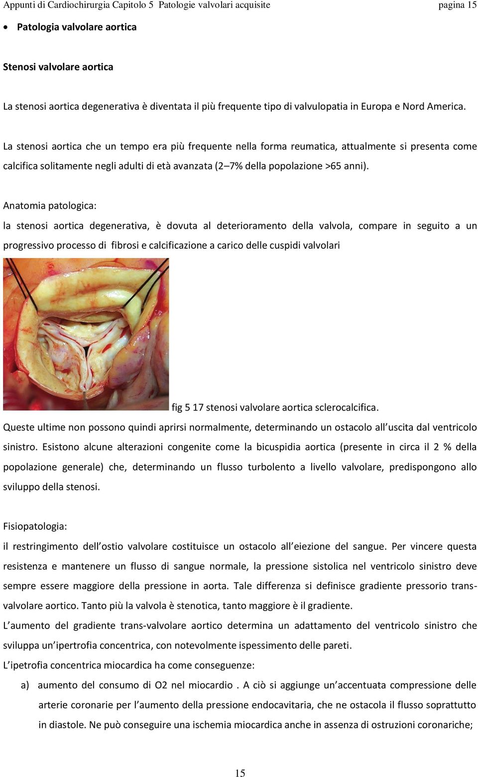 La stenosi aortica che un tempo era più frequente nella forma reumatica, attualmente si presenta come calcifica solitamente negli adulti di età avanzata (2 7% della popolazione >65 anni).