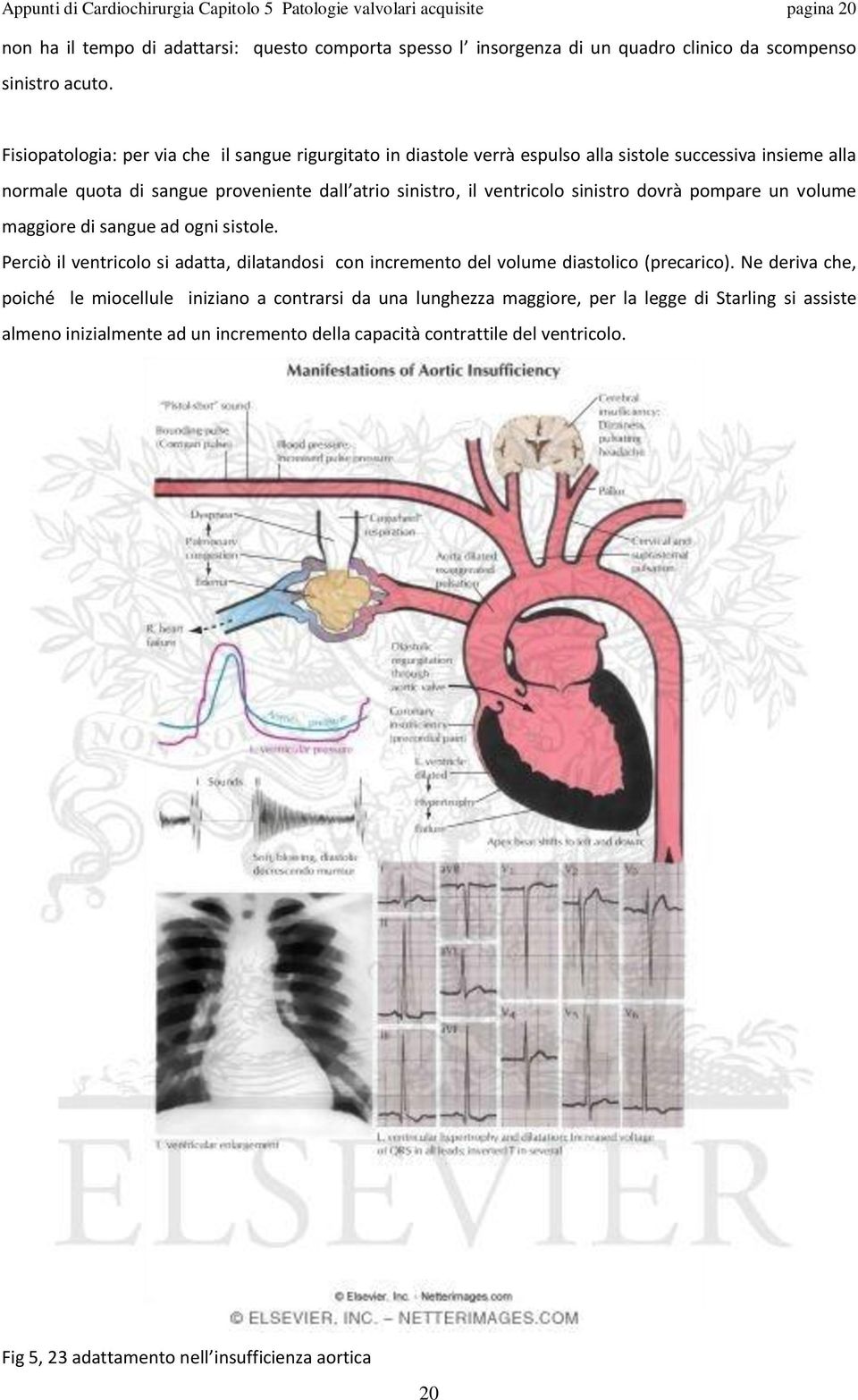 dovrà pompare un volume maggiore di sangue ad ogni sistole. Perciò il ventricolo si adatta, dilatandosi con incremento del volume diastolico (precarico).